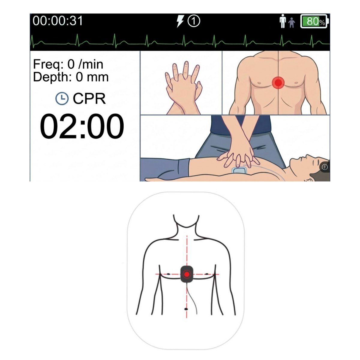 HTM Medico heartsine lifepak Primedic Zoll Lifeline AED CPR
